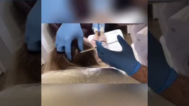 Плазмолифтинг в Марлен - эффективное решение для роста волос! смотреть онлайн