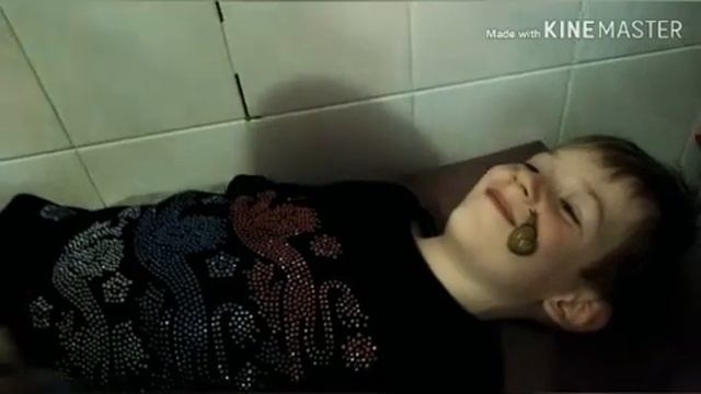Улитки лазят по лицу ?! ШОК! смотреть онлайн