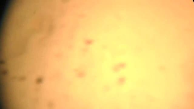 Otodectos cynotis (ушной клещ у кошек, видео микроскопии) смотреть онлайн