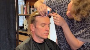 Алопеция у мужчин. Мужская система замещения волос. Фиксация накладки из волос. До и после.