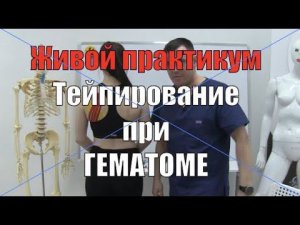 Кинезиотейпирование при гематоме