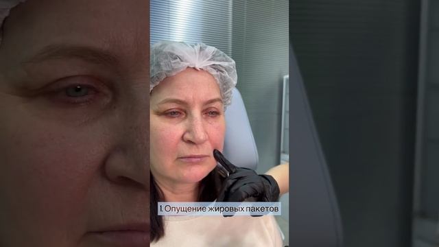 Почему образуются носогубные складки? смотреть онлайн