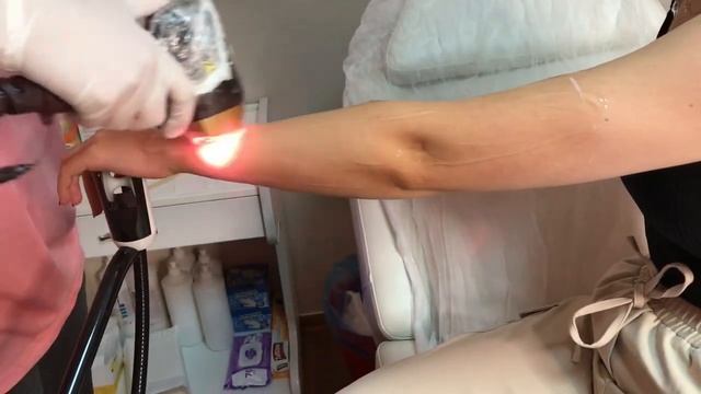 YÜZÜME LAZER YAPTIRDIM. SOPRANO BUZ LAZER UYGULAMALI SEANS ? смотреть онлайн