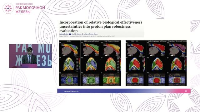 Современные технологии лучевой терапии при раке молочной железы: IMRT, Vmat, протоны смотреть онлайн