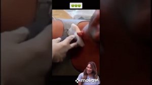 Топ 10 ужасные гнойники ?????2021 г.