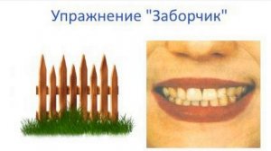 Артикуляционная гимнастика для детей. Артикуляционное упражнение заборчик. Детский логопед.