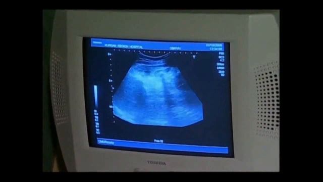 2 3 3 Подари мне жизнь смотреть онлайн