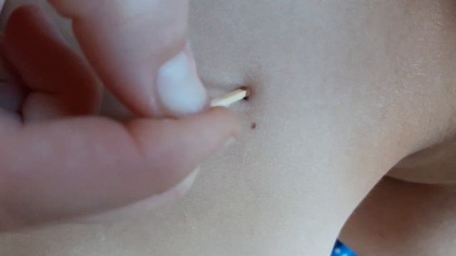 Как вытаскивать клеща с помощью спички #клещ #укусилклещ смотреть онлайн