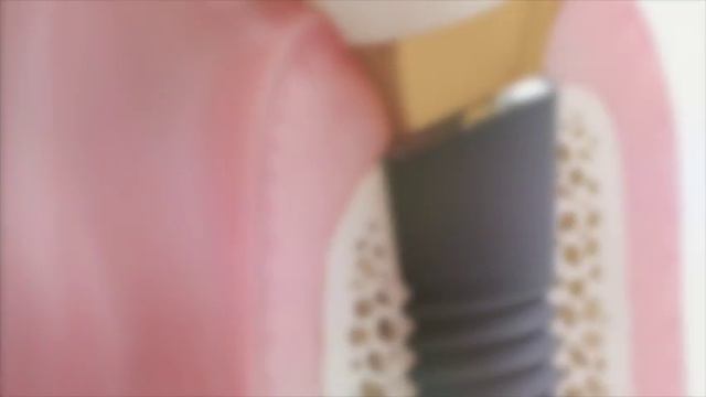 Damals und heute: 10 Jahre Praxisklinik Baden Baden смотреть онлайн