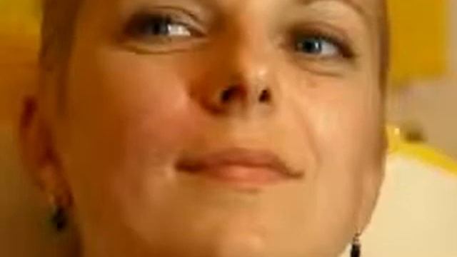 Пластика лица Носогубная складка смотреть онлайн