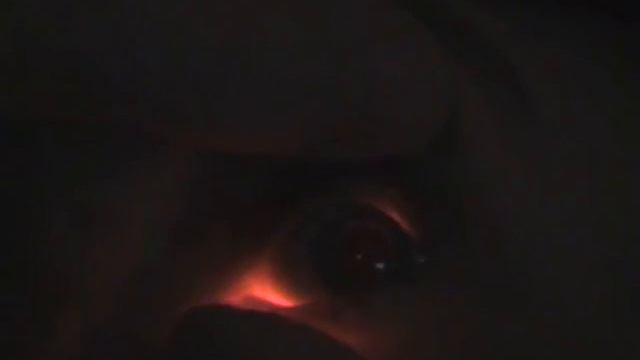 Диафаноскопия