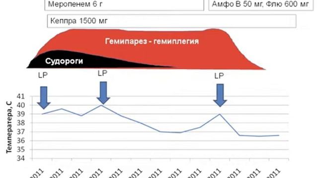 1МСН Невролгичесгие осложнения в гематолнии смотреть онлайн