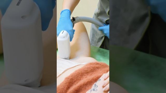Лазерная эпиляция в Киеве смотреть онлайн