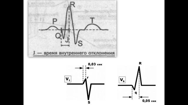 Электрокардиография. Гипертрофии отделов сердца.