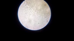 Трихомонада под микроскопом. Простейшие под микроскопом