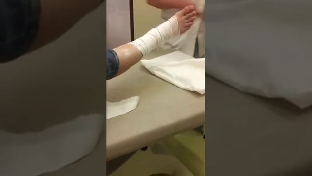 Cнимает гипс