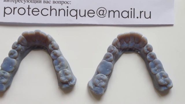 Как выровнять кривые зубы без брекетов у взрослых? Прозрачные зубные каппы -голливудская улыбка. смотреть онлайн