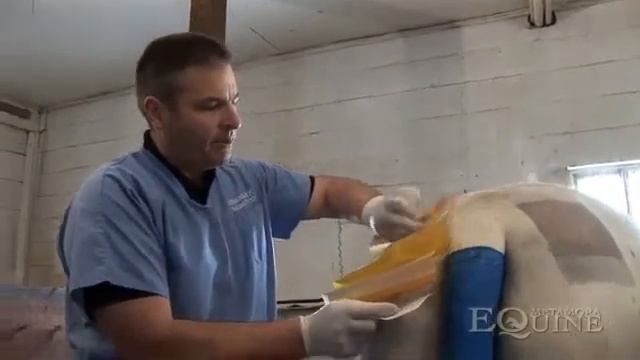 Harvesting Adipose Tissue: Liposuction смотреть онлайн