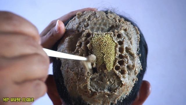 Not Satisfying !! Removing White Worms On Dandruff (M255) смотреть онлайн