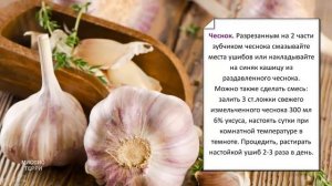Как избавиться от синяка