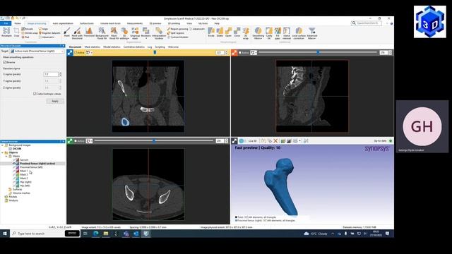 3D GRAPHY - 3D SEGMENTATION DEMO BY SIMPLEWARE SYNOPSYS SCAN IP смотреть онлайн