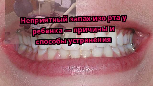 Неприятный запах изо рта у ребенка — причины и способы устранения смотреть онлайн