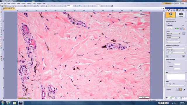 Dirk Elston - Dermatopathology slides External Agents Dec 7, 2015 смотреть онлайн