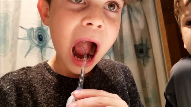 Flossing Made Fun & Easy With the Oral Irrigator смотреть онлайн