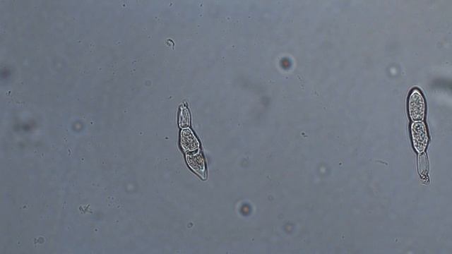 Белая ржавчина хризантем (Puccinia Horiana Henn.)