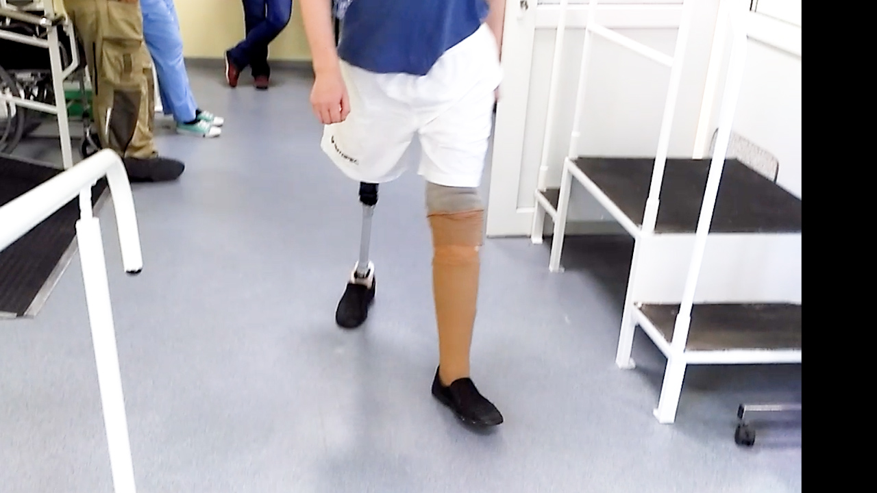 На протезах ног пошёл без трости смотреть онлайн