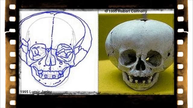 Удлинённые черепа ! смотреть онлайн