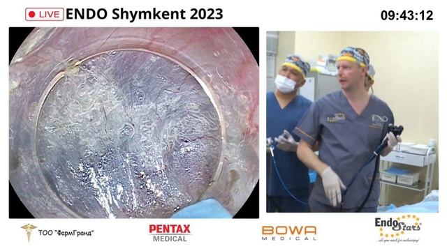 Endo Shymkent 2023. POEM смотреть онлайн