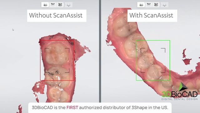 Ultimate TRIOS 5 Scan Engine: ScanAssist смотреть онлайн