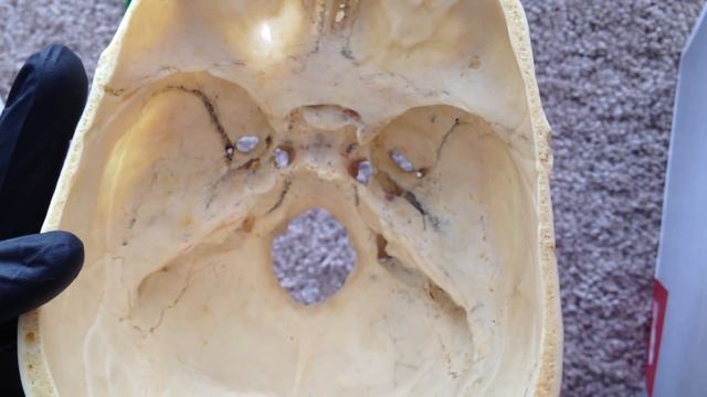 The Skull Bones - Cranial foramina and contents смотреть онлайн