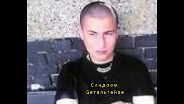Синдром Бетельгейзе "На северо-запад через северо-восток" смотреть онлайн
