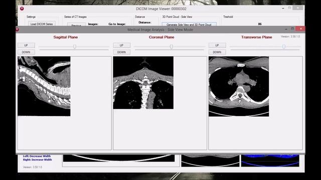 Medical Image Analysis, DICOM Viewer - Point Cloud 3D Reconstruction (TUKE) смотреть онлайн