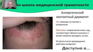 Заболевания кожи головы