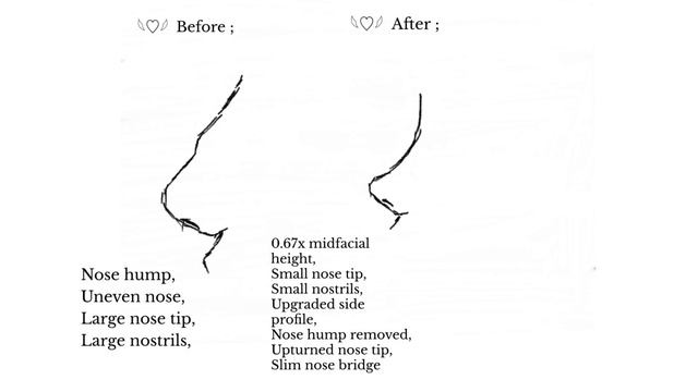 “ ᵛⁱʳᵗᵘᵃˡ ⁿᵒˢᵉ ˢᵘʳᵍᵉʳʸ “ ; Nose reconstruction subliminal ♡¸.•* Ultra Effective ? смотреть онлайн