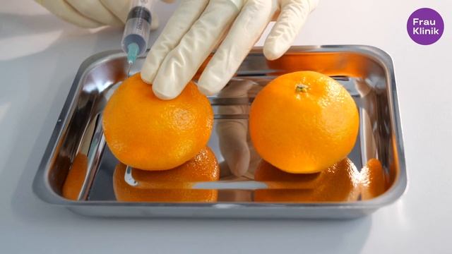 ШОК: Введение филлера в МАНДАРИН! Посмотри как меняется объем смотреть онлайн