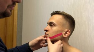 Наложение кинезио тейпа на тройничный нерв.