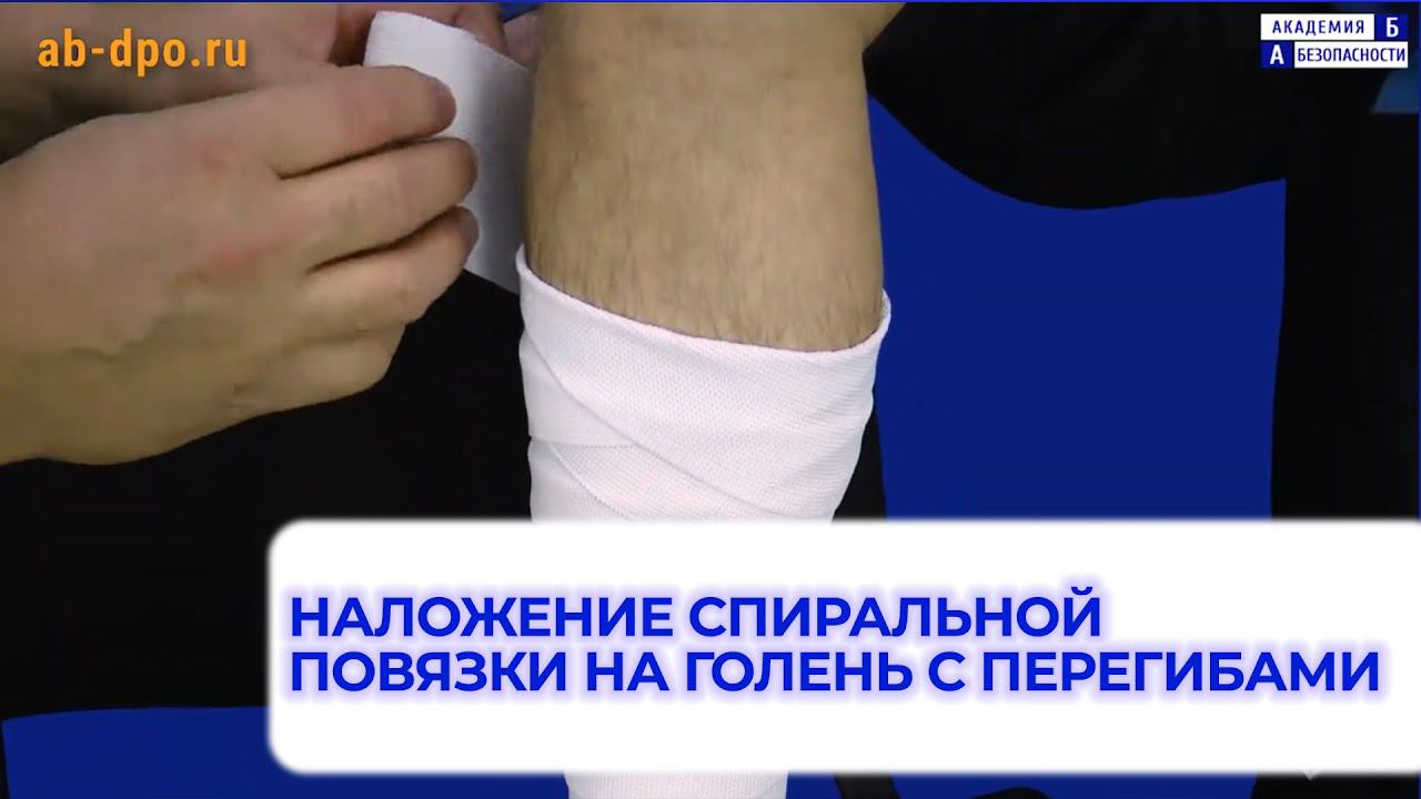 Наложение спиральной повязки на голень с перегибами