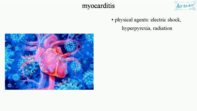 Myocarditis