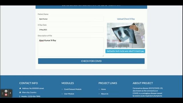 Covid Detection Using X Ray and CT Scan - Python Machine Learning Project смотреть онлайн