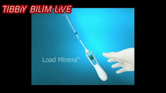 SPIRAL.Spiral Qo'yish Jarayoni,homiladorlikdan Saqlavchi Vositaa