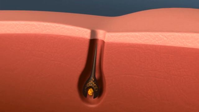 Цикл роста волос смотреть онлайн