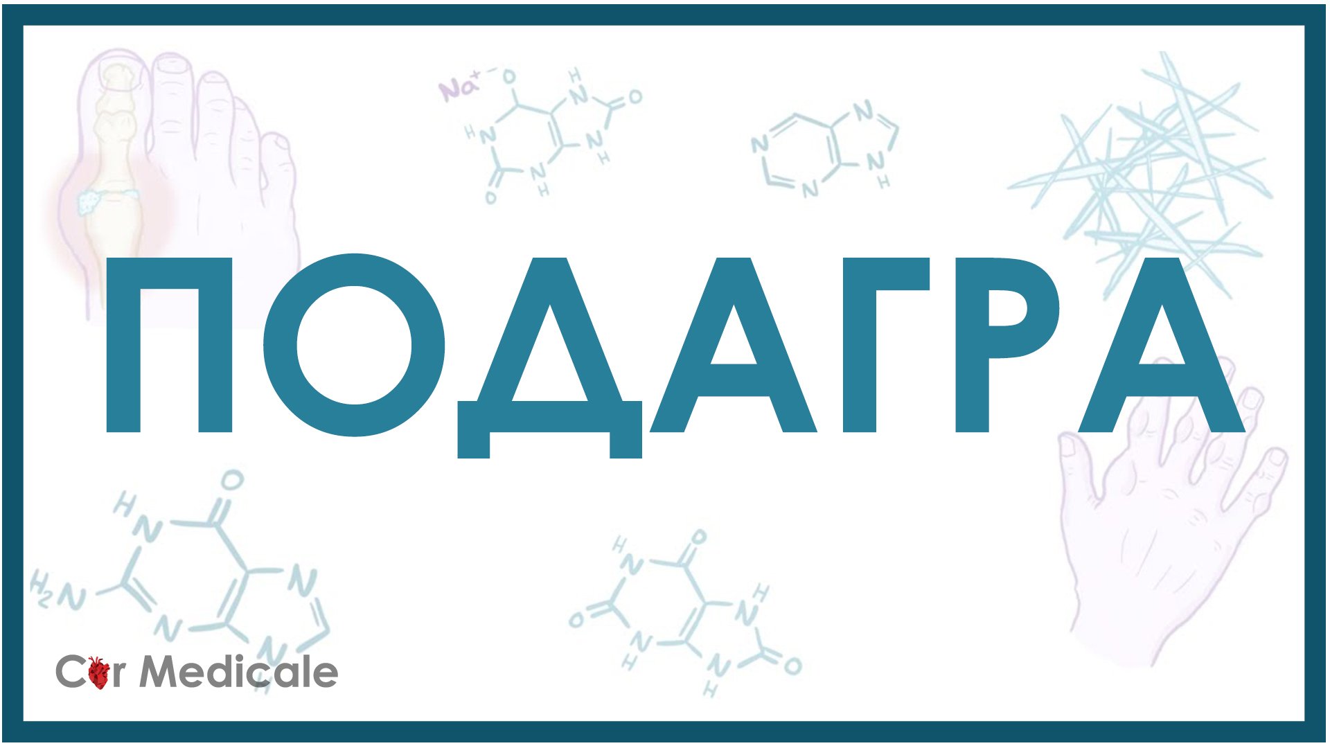 Подагра - причины, проявления, механизм развития, симптомы, принципы лечения смотреть онлайн