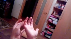 Сломанный палец