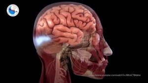 Мигрень: что это такое?