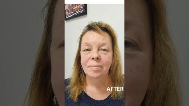 Холодная плазма (видео №8) смотреть онлайн