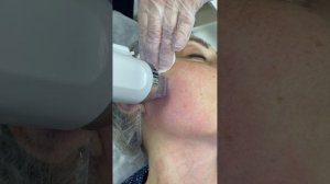 Семинар - обучение «Микроигольчатый РФ-лифтинг»